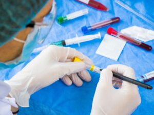 Hypertrophic Cardiomyopathy Genetic Testing: Unveiling the Mystery Behind Your Heart Health